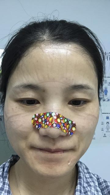 s_劉洋-花創可貼_202003041601498.jpg
