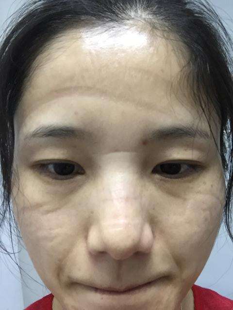 s_劉洋摘口罩202003041601499.jpg